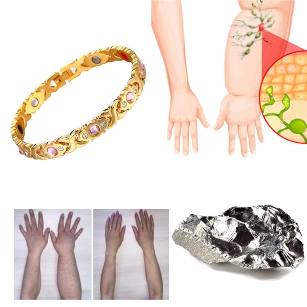 Lymfdränering magnetiskt armband bantningsarmband för kvinnor Rose Gold
