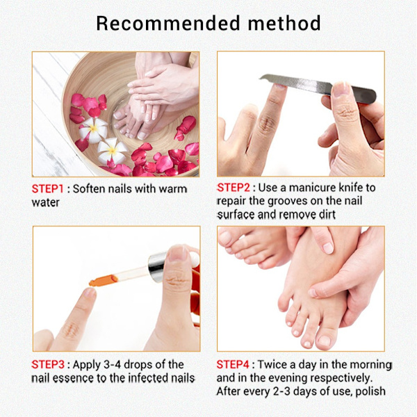 Nail Treatment Nail Repair Essence Foot Care