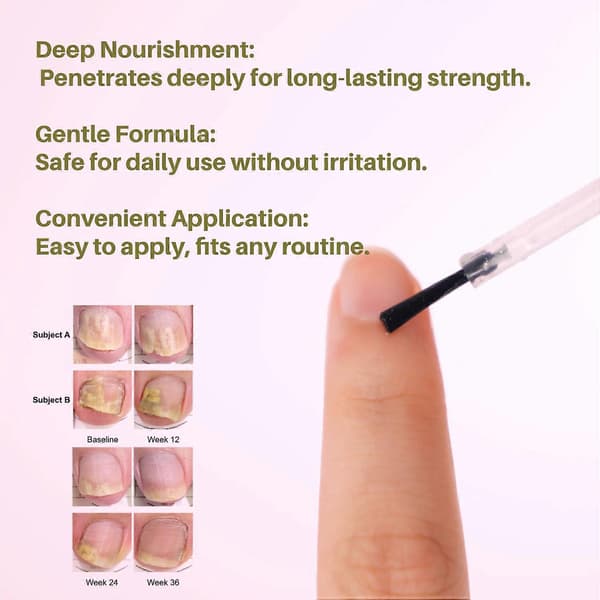 UltraGrow Negleserum til Vækst og Styrke med Keratin Complex, Olivenolie & E-vitamin