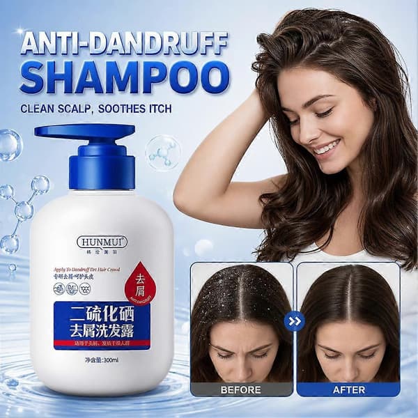 Anti-skælshampoo - Selendisulfidbehandling til kløende hovedbund