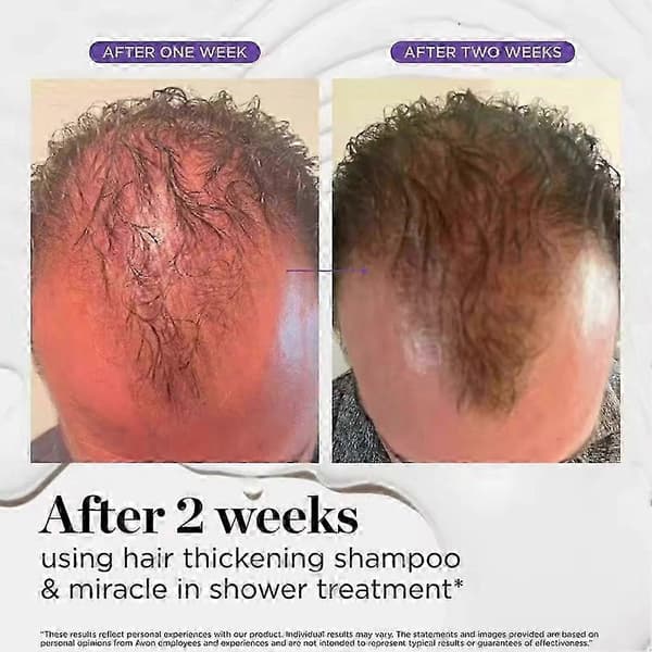 Dr Groot Scalp Revitalizing Solution Hårförtjockande Olja Schampo Balsam NaixDC conditioner