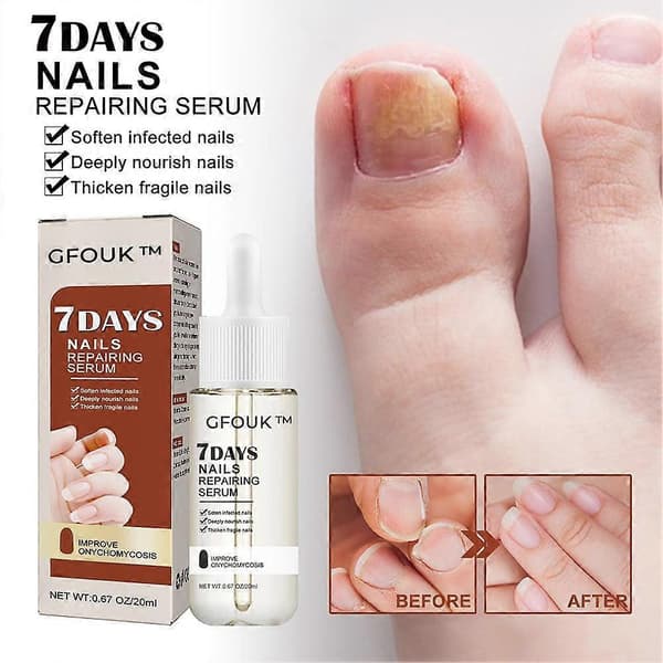 GFOUK Neglesvamp 7 dages neglevækst og styrkende serum 20ml