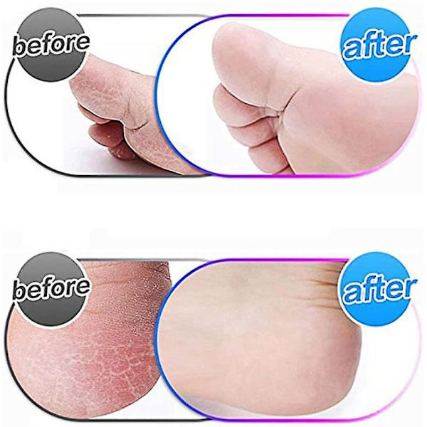 [4 Pack] Ekstra grove erstatningsruller som er kompatible for Emjoi Micro Pedi-erstatningsruller