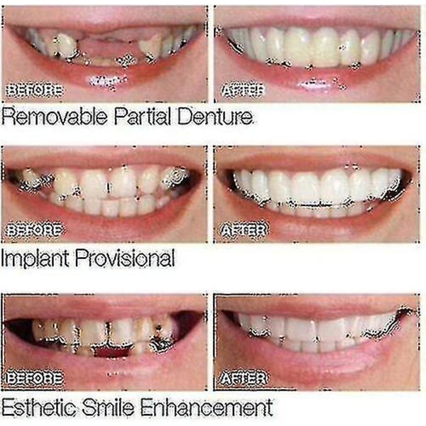 Smile Knäpp på falska tänder Övre nedre tandfasader Tandproteser Cover Set