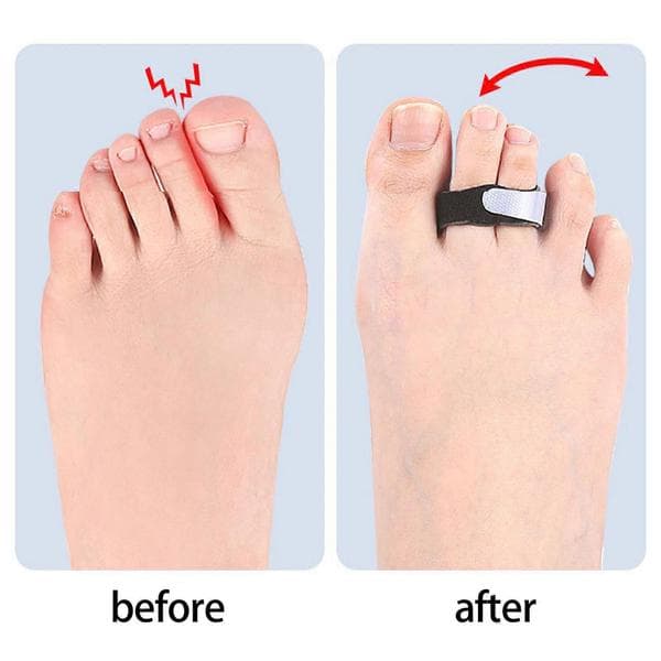 5 stykker fingerstropper til støtte og fiksering af skadede fingre Finger Buddy-stropper til hævede og deformiteter L L
