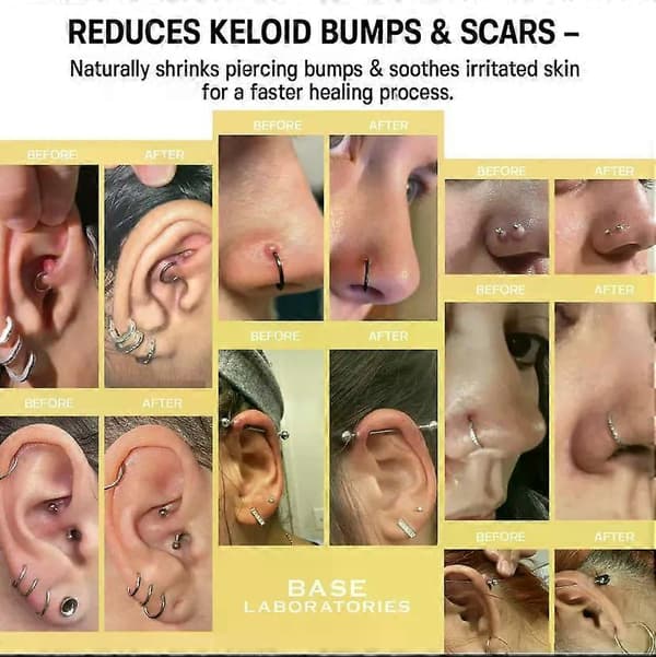 Piercing Bump Solution & Keloid Bump Removal | Beroligende Piercing Efterbehandling til Piercing Bumps & Keloid Arfjernelse | Øre- & Næsekeloid Bumps Piercing 2PCS