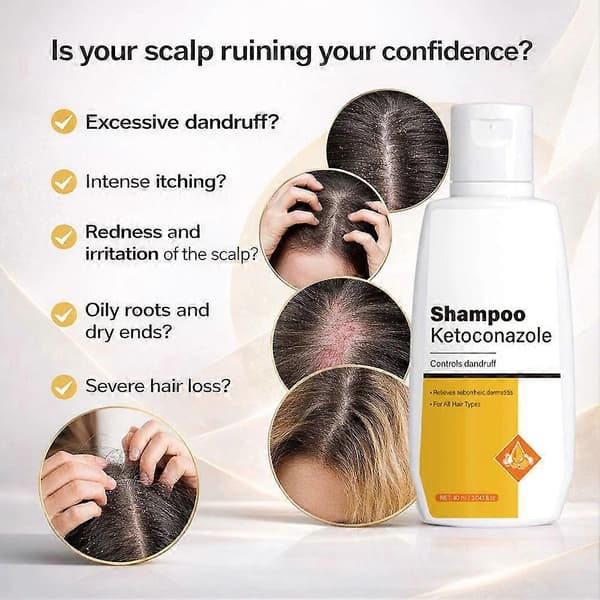 Anti-skælshampoo med 1% Ketoconazol, frisk aroma, 90 ML