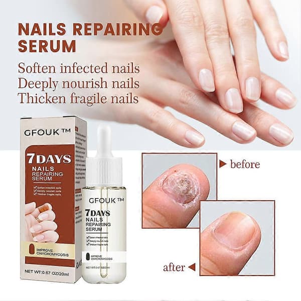 GFOUK Neglesvamp 7 dages neglevækst og styrkende serum 20ml