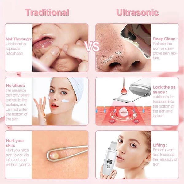 Peeling Blackhead Remover Dyprenseverktøy for Poreekstraksjon for Hjem og Reise Vit