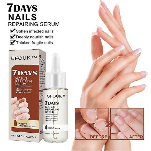 GFOUK Neglesvamp 7 dages neglevækst og styrkende serum 20ml