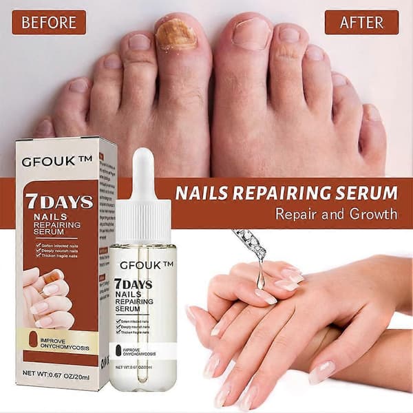 GFOUK Neglesvamp 7 dages neglevækst og styrkende serum 20ml