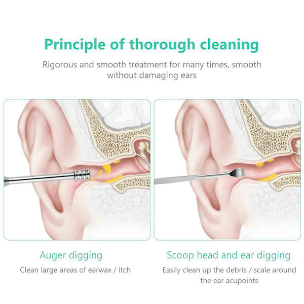 5st Öronplockningsset - Enkel Vaxrengöring