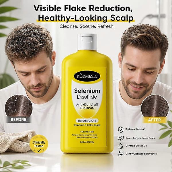 Seleendisulfidi hilseenvastainen shampoo - 250g