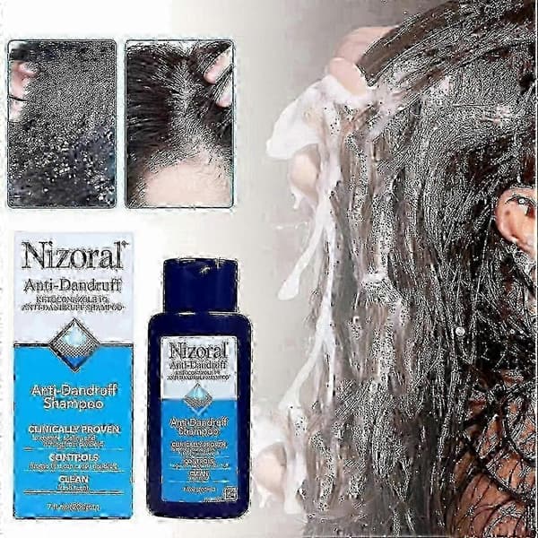 Nizoral 7 fl oz 200ml hilse shampoo 2025