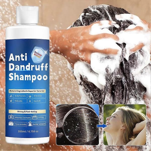 200 ml hilsettä ehkäisevä shampoo, vahva ja nopeavaikutteinen
