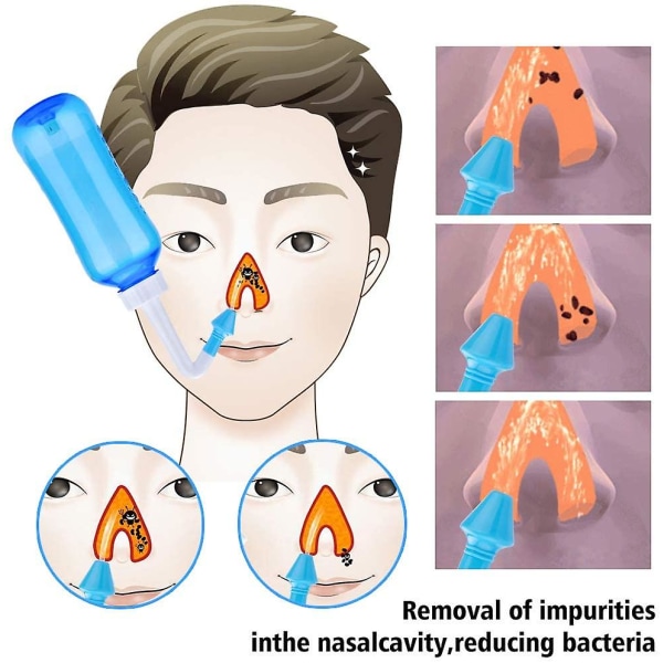 Næseskylning, næseirrigation vaskeflaske 300 ml, Neti Pot Kit til voksne og børn med næseskylningssalt 30 pakker