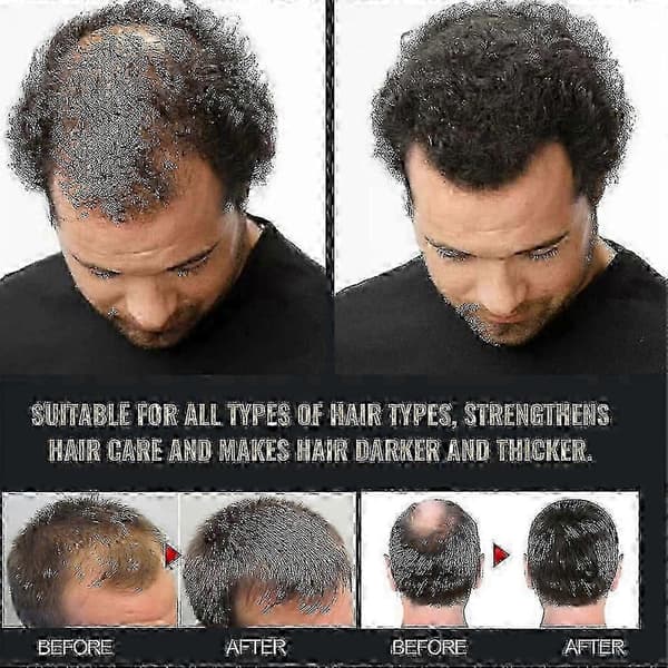 3 stk. Spartan Root Shampoo, Spartan Shampoo, shampoo Root