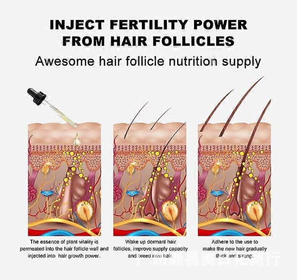 Håråterväxt 7 dagar, ingefära grodd eterisk olja hårväxt håravfall behandling hårvård hårväxtserum för män och kvinnor 30 ml (1-pack) 2PCS