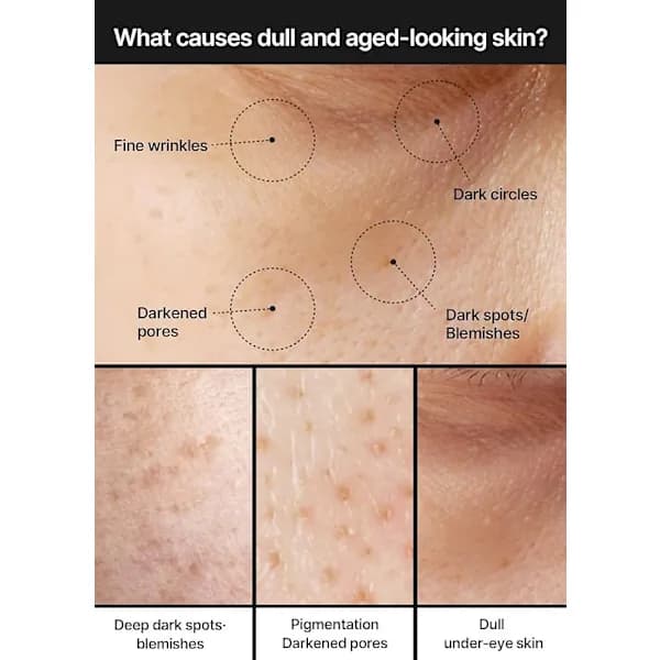 Pore-refining brightening cream - contains niacinamide, tranexamic acid and TXA