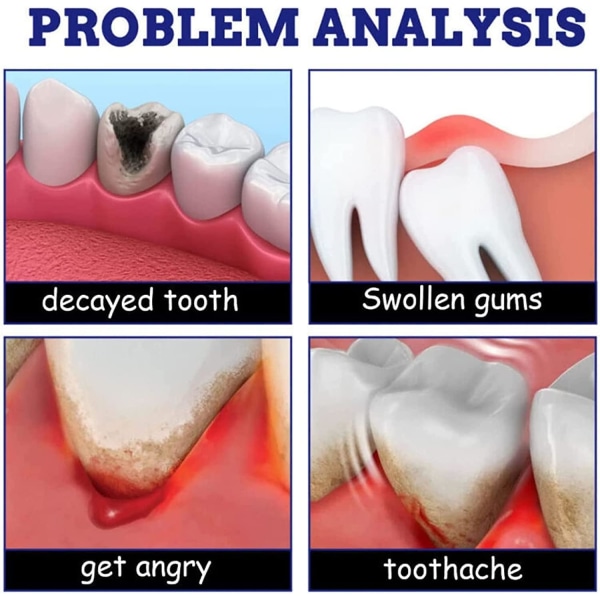 Remedies Teeth & Gums Spray, Instant Teeth Treatment Relief Tandvärksprayer, Tandvärk Reparation Gingival vävnad 1pcs