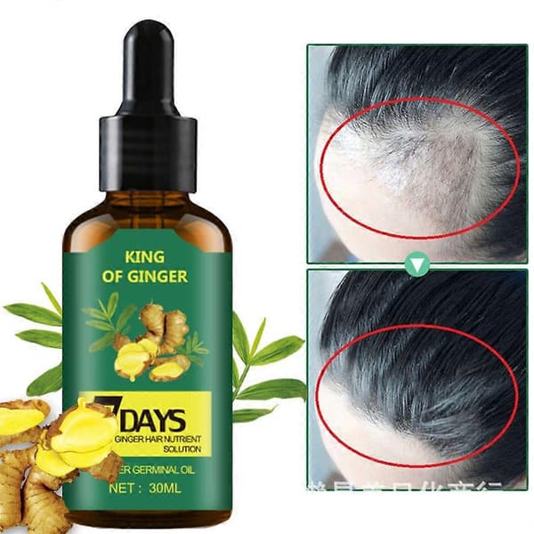 Håråterväxt 7 dagar, ingefära grodd eterisk olja hårväxt håravfall behandling hårvård hårväxtserum för män och kvinnor 30 ml (1-pack) 2PCS