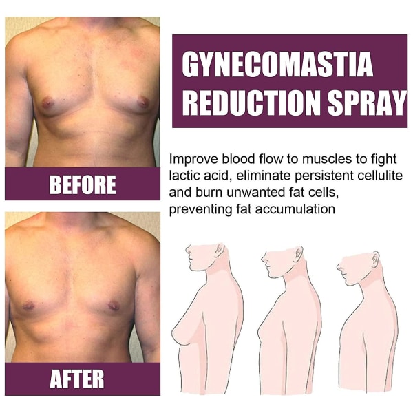 Gynecomastia-reduceringsspray, gynecomastia-reducerande cellulitspray, bröstområde magefettborttagare för män, gör bröstformen hård och stark 1 Pcs