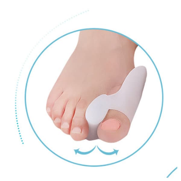 2 par hallux valgus-korrigerare, tåskydd