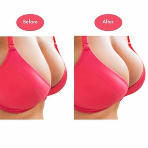 Silikoni insertit rintaliiveihin - Oval 80g