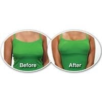 Brysttape - Instant lift - 10 stk