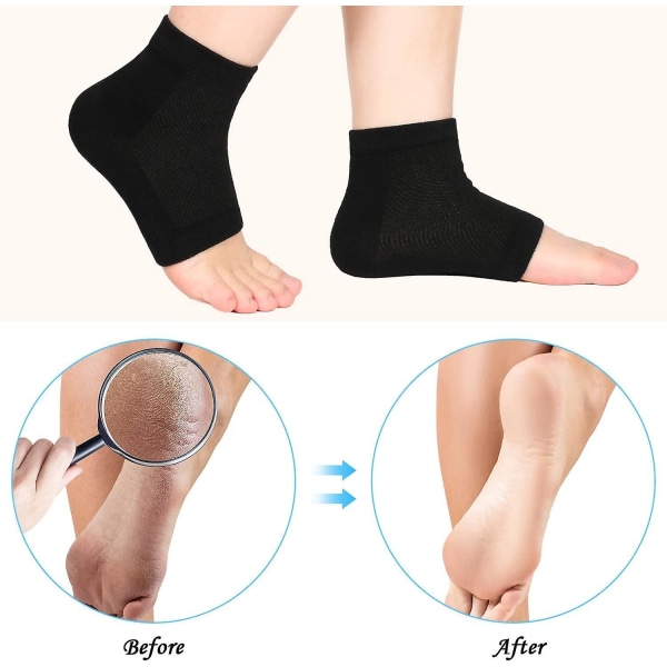 Soft Gel-hælstrømper ventilerer sokker med åben tå 4 par (sort)