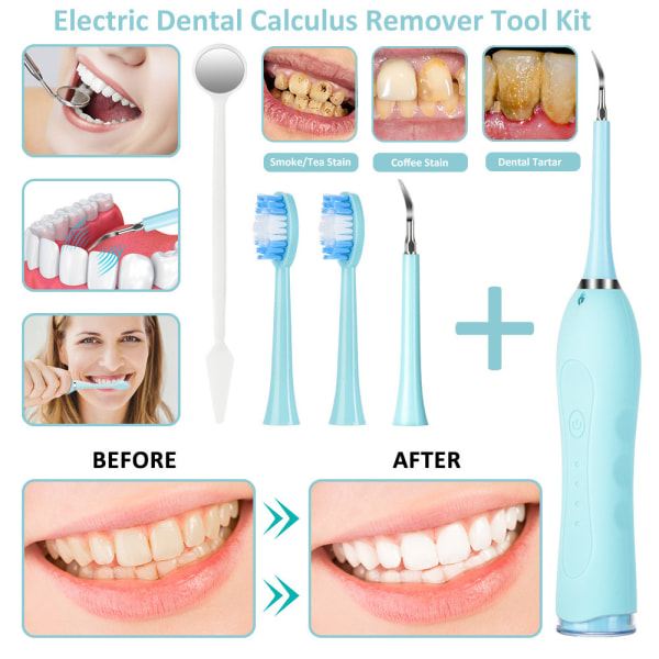 Sonic Electric Dental Scaler Tänder Calculus Plackfläckar Ta bort