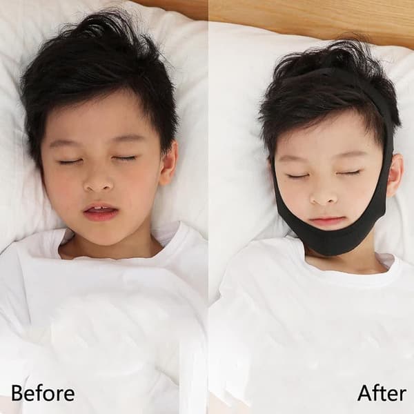 Justerbar Anti-Snork Chin Strap, Sort Anti-Snork Strap, Til Mig
