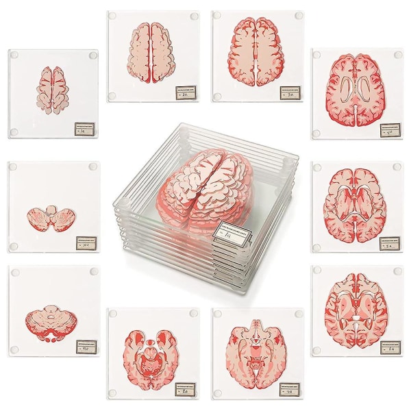 Anatomic Brain Specimen Coasters-presenter för medicinsk studentpresenter Brain Decor Human Anatomy