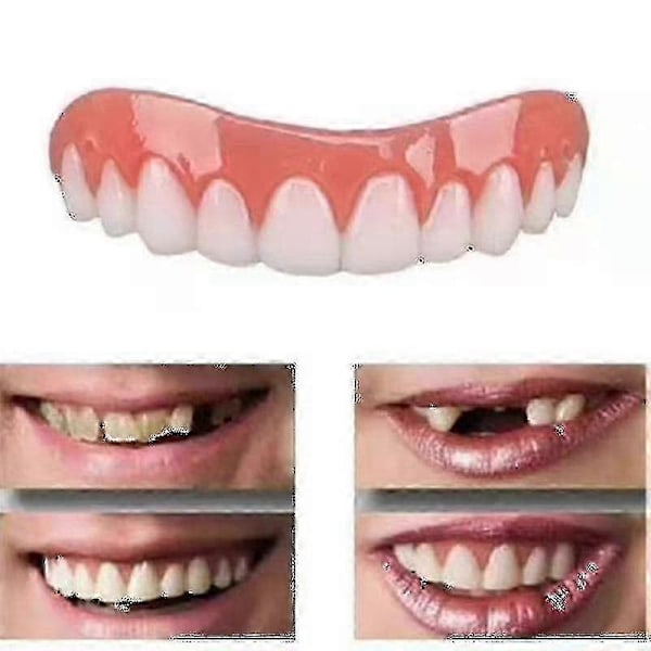 2 Sets Of Dentures, Upper And Lower Jaw Dentures, Natural And Comfortable, Protect The Teeth, And Regain A Confident Smile Hk