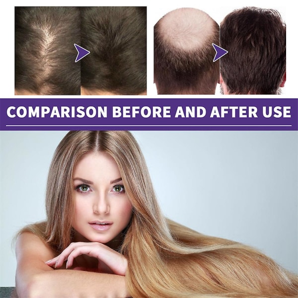 9 stk Hair Care Essence Massage Hårreparation Beskadiget hår Hovedbundspleje Næringsopløsning