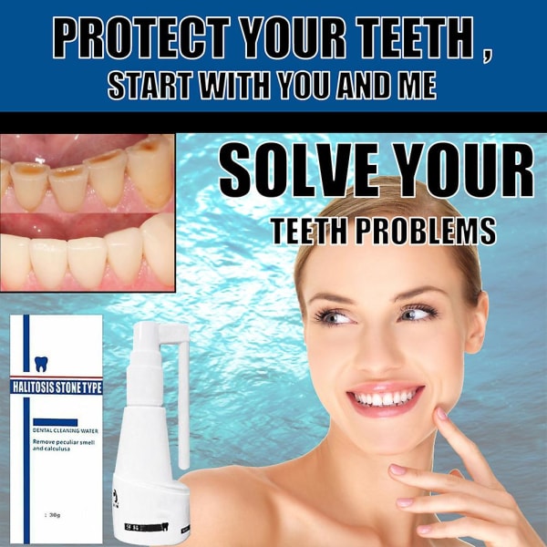 2kpl Hammaskiven liuotussuihke hammaskivenpoistoaine Hampaiden puhdistusaine Suun hampaiden hoito