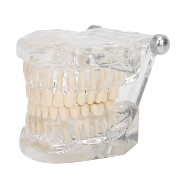 Dental Undervisning Simuleringsmodell Akryl Transparent Tänder Modell