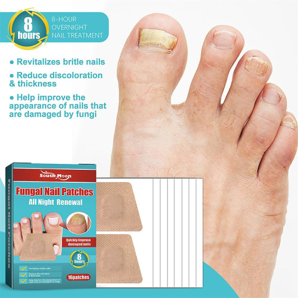 48 stk indgroede tåneglekorrigerende klistermærker Paronychia Treatment Pedicure Tå Neglepleje Korrektor Patch Correction Stickers