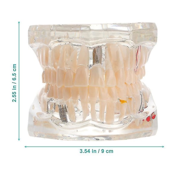 Menneskelige tænder Anatomisk model Transparent medicinsk tandsygdom mundhule undervisningsmodel