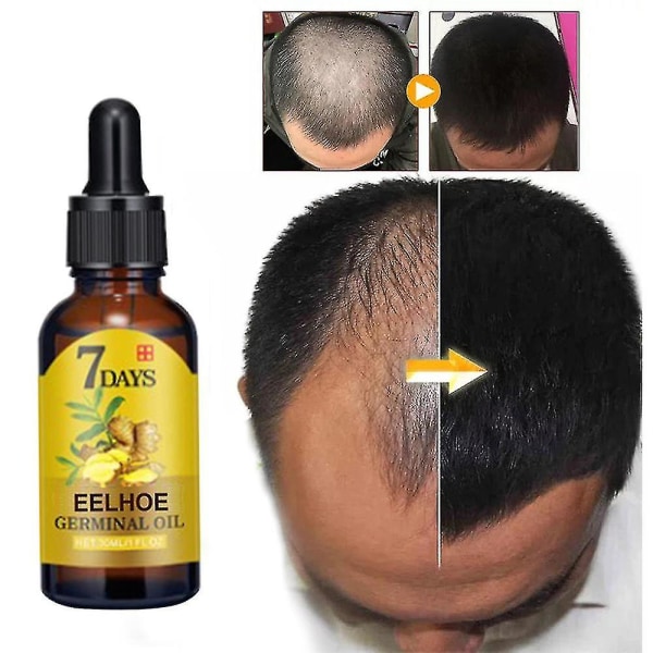 New2023 Eelhoe Ginger Hair Tonic nærer hårrødder, forbedrer hårets lyshed, styrker håret, forhindrer nedfald