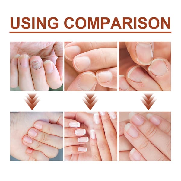 Jaysuing 7-dagars nagelreparationsserum, nageltillväxtstärkande serum (Tw)