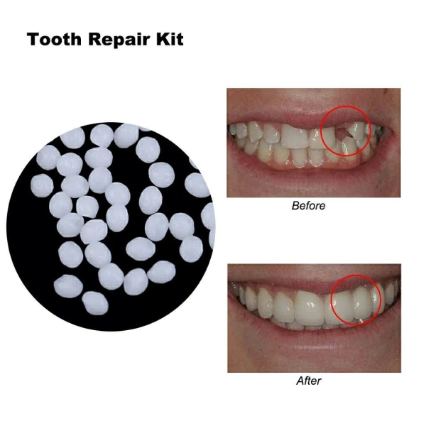 Hampaan vaihtomateriaali Hampaiden täyttö hammasproteesin liima 25G