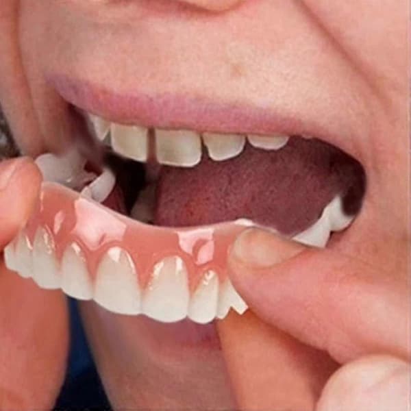 Extra Thin False Bright White Tooth Veneers Silicone Soft Safe Adhesive Denture Cover Shade Braces Comfortable Teeth Orthodontics
