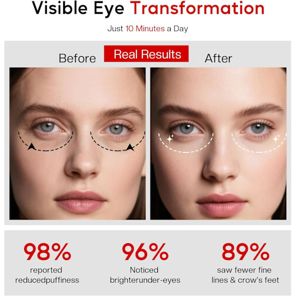 Under-Eye Rött Ljus Terapi Glasögon med 3D-passform & Mikroströmsmassage - Portabel Ögonvård för Mörka Ringar Svullnader & Trötthet från Skärm