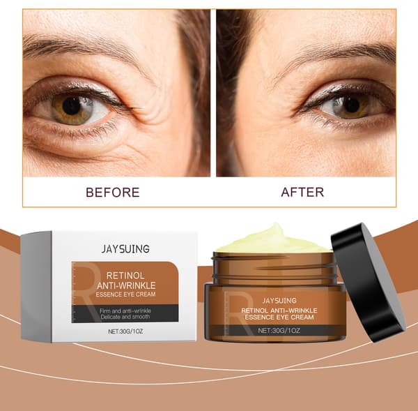 Retinol Essence -silmänympärysvoide parantaa kimmoisuutta ja kosteuttaa silmänympärysihoa.