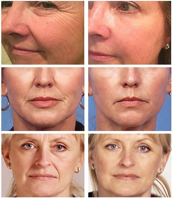 Retinol Serum, hydrating, moisturizing, firming and pore-minimizing ampoule serum, 20 ml