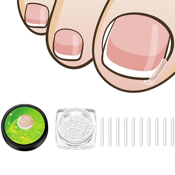 50/100 st Inväxta Nagelkorrigeringsremsor Nagelkorrigeringslappar Böjda Naglar Riktning Återhämtning Klämmor för Män Kvinnor Fotvård