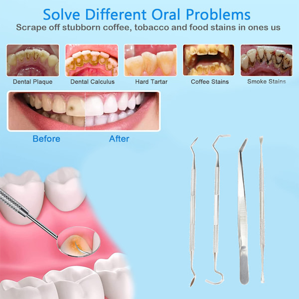 Portabel Tandpetare Set i Rostfritt Stål, för Utomhus Picknick Camping Resor