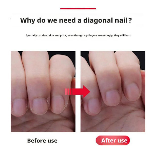 Nagelklippare Sned Mun Rakt Form Döda Hud Nagelklippare Skydd Stor Spets Nagel M2S4 Flat Head 1pcs