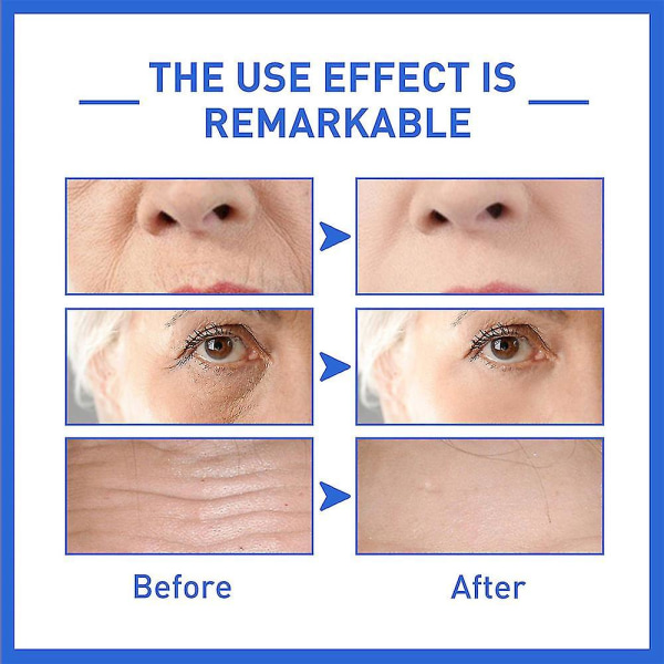 1/2 st Botox Stock Solution Serum Anti Aging Anti Wrinkle Face Moisturizing Essence